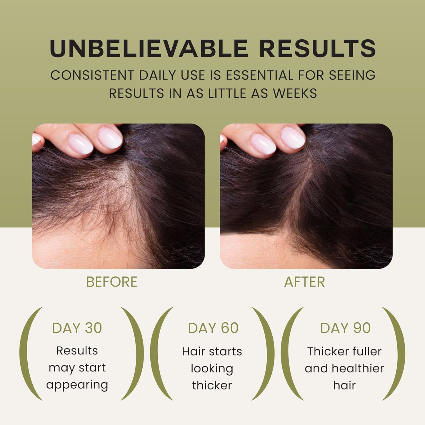 The Wonder Growth Oil Serum